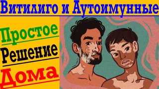 Витилиго и Аутоиммунные заболевания ! Как избавиться от Витилиго в домашних условиях !