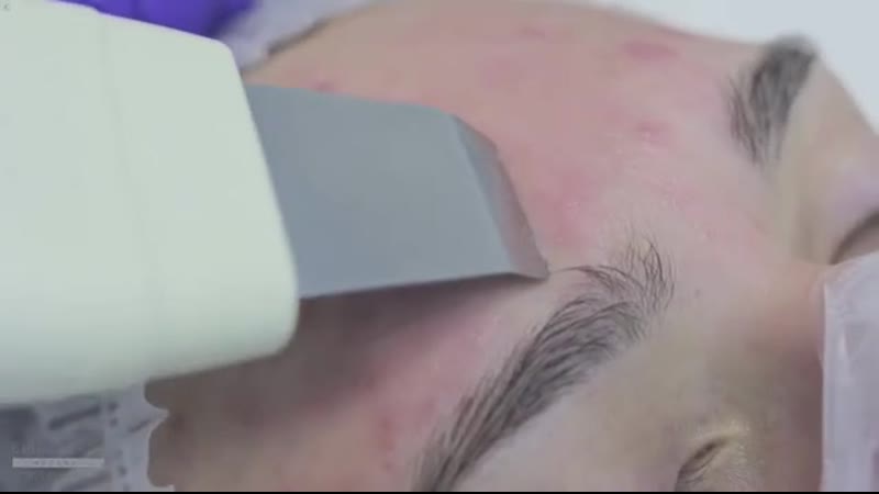 Видео от Medical Collagene 3