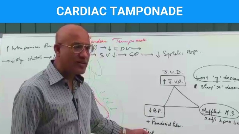 Cardiac Tamponade Causes, Symptoms