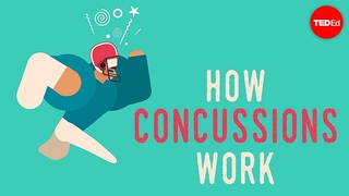 What happens when you have a concussion - Clifford Robbins
